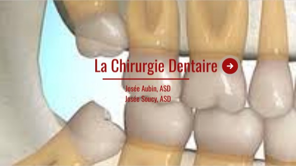 La Chirurgie dentaire | Genially