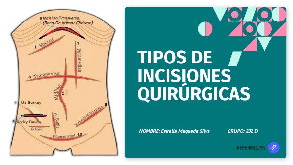 Tipos de incisiones quirúrgicas | Genially