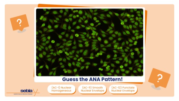 Guess the Pattern - Week 1 - 2025 | Genially