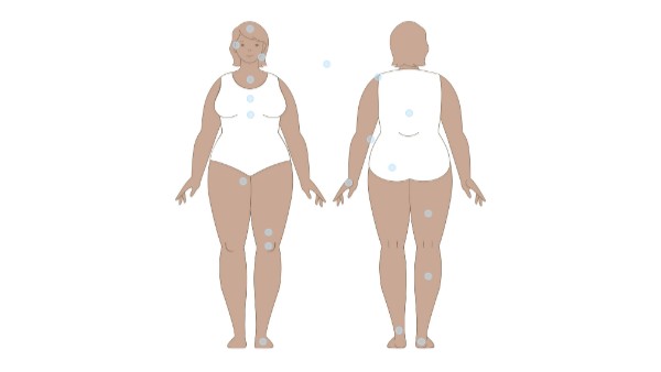 Symptom Map | Genially