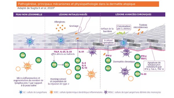 Pathogénèse, principaux mécanismes et physiopathologie dans la ...